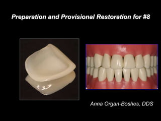 Preparation and Provisional Restoration for #8
Anna Organ-Boshes, DDS
 