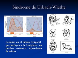 Síndrome de Urbach-Wiethe Lesiones en el lóbulo temporal  que incluyen a la Amígdala : no pueden reconocer expresiones de miedo. 