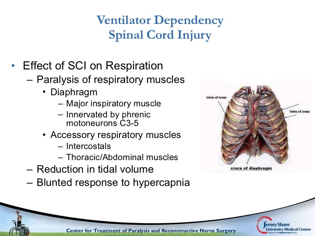 Comprehensive surgical management of the paralyzed diaphragm