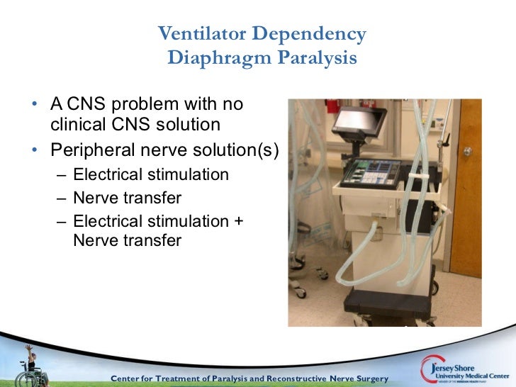 Comprehensive surgical management of the paralyzed diaphragm