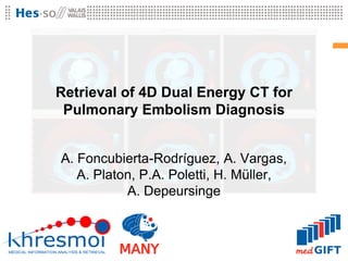 Retrieval of 4D Dual Energy CT for
 Pulmonary Embolism Diagnosis


A. Foncubierta-Rodríguez, A. Vargas,
   A. Platon, P.A....
