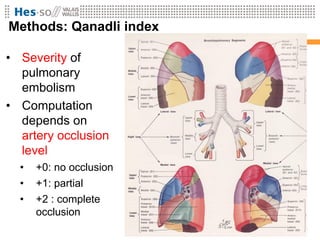 Methods: Qanadli index

• Severity of
  pulmonary
  embolism
• Computation
  depends on
  artery occlusion
  level
  •   +...