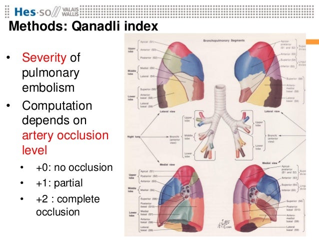 Retrieval of 4D Dual Energy CT for Pulmonary Embolism Diagnosis