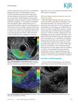 EUS Elastography


and 94%, respectively. However Hirche et al. (9) published             higher than 15.41 or a mass elasticity value below 0.03% is
disappointing results on the elastography in terms of                  100% specific for malignancy.
its ability of predicting the nature of pancreatic lesions
with poor diagnostic sensitivity (41%), specificity (53%),             Differential Diagnosis Between Pancreatic Cancer and
and accuracy (45%). Variable diagnostic accuracy among                 Chronic Pancreatitis
elastographic studies may result from intrinsic limitations of            Differential diagnosis between pancreatic cancer and
qualitative elastography; it is the subjective interpretation          chronic pancreatitis may be difficult, particularly in cases
of the elastographic pattern. Igelsia-Garcia et al. (11)               of advanced pancreatitis (12). Accuracy of EUS in this
published the quantitative analysis for the differentiation of         setting may not be higher than 75% (13). Histology is the
solid pancreatic masses with higher specificity (92.9%) and            gold standard, but even a biopsy can be difficult because
accuracy (97.7%) compared to the qualitative analysis (Table           cancers can produce a marked fibrotic reaction or necrosis
1). Based on the results, a strain ratio higher than 6.04 or           and give false results. EUS-FNA sensitivity and diagnostic
a mass elasticity lower than 0.05% is 100% sensitive for               accuracy are 75-92% and 79-92%, respectively (14). EUS
correctly classifying tumors as malignant. A strain ratio              elastography may add some important information in this
                                                                       setting. Diffuse abnormalities of pancreatic parenchyma in
                                                                       chronic pancreatitis are not a limitation for elastography
                                                                       because only the solid mass under evaluation is included
                                                                       in the ROI. Based on Iglesias-Garcia study, the accuracy
                                                                       of qualitative EUS analysis was up to 20% if inflammatory
                                                                       masses are misclassified as cancer. Importantly enough,
                                                                       false positive but not false negative results for malignancy
                                                                       occurred (6). The quantitative EUS analysis improved
                                                                       the diagnostic accuracy for diagnosing malignancy (8).
                                                                       Therefore EUS elastography might be particularly helpful in
                                                                       situations in which the accuracy of EUS-FNA is suboptimal.

                                                                       Limitation of EUS Elastography
Fig. 3. EUS elastography of normal pancreas EUS. Elastographic
imaging of normal pancreas is characterized by uniform, homogenous
                                                                         The main pitfall of EUS elastography is the inability to
green color distribution (representing intermediate stiffness).        control tissue compression by the EUS transducer (5). The




Fig. 4. EUS elastography of pancreatic cancer. Elastographic imaging of pancreatic cancer is characterized by heterogeneous blue color
distribution (representing hard stiffness).


kjronline.org         Korean J Radiol 13(Suppl 1), Jan/Feb 2012                                                                          S15
 