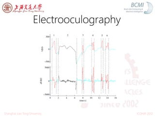 Electrooculography
ICONIP 2012Shanghai Jiao Tong University
 