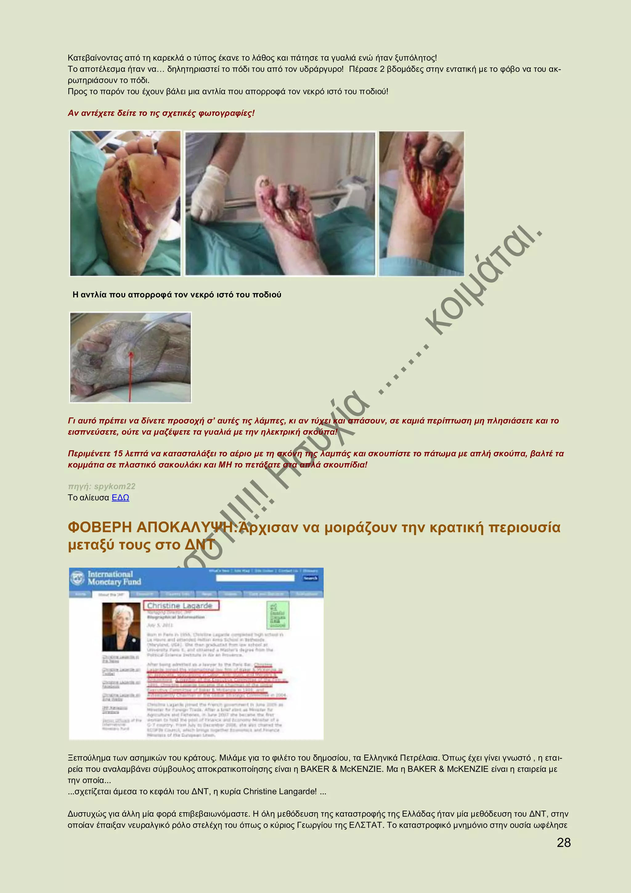 Κατεβαίνοντας από τη καρεκλά ο τύπος έκανε το λάθος και πάτησε τα γυαλιά ενώ ήταν ξυπόλητος!
Το αποτέλεσμα ήταν να… δηλητηριαστεί το πόδι του από τον υδράργυρο! Πέρασε 2 βδομάδες στην εντατική με το φόβο να του ακ-
ρωτηριάσουν το πόδι.
Προς το παρόν του έχουν βάλει μια αντλία που απορροφά τον νεκρό ιστό του ποδιού!

Αν αντέχετε δείτε το τις σχετικές φωτογραφίες!




 Η αντλία που απορροφά τον νεκρό ιστό του ποδιού




Γι αυτό πρέπει να δίνετε προσοχή σ’ αυτές τις λάμπες, κι αν τύχει και σπάσουν, σε καμιά περίπτωση μη πλησιάσετε και το
εισπνεύσετε, ούτε να μαζέψετε τα γυαλιά με την ηλεκτρική σκούπα!

Περιμένετε 15 λεπτά να κατασταλάξει το αέριο με τη σκόνη της λαμπάς και σκουπίστε το πάτωμα με απλή σκούπα, βαλτέ τα
κομμάτια σε πλαστικό σακουλάκι και ΜΗ το πετάξατε στα απλά σκουπίδια!

πηγή: spykom22
Το αλίευσα ΕΔΩ


ΦΟΒΕΡΗ ΑΠΟΚΑΛΥΨΗ:Άρχισαν να μοιράζουν την κρατική περιουσία
μεταξύ τους στο ΔΝΤ




Ξεπούλημα των ασημικών του κράτους. Μιλάμε για το φιλέτο του δημοσίου, τα Ελληνικά Πετρέλαια. Όπως έχει γίνει γνωστό , η εται-
ρεία που αναλαμβάνει σύμβουλος αποκρατικοποίησης είναι η BAKER & McKENZIE. Μα η BAKER & McKENZIE είναι η εταιρεία με
την οποία...
...σχετίζεται άμεσα το κεφάλι του ΔΝΤ, η κυρία Christine Langarde! ...

Δυστυχώς για άλλη μία φορά επιβεβαιωνόμαστε. Η όλη μεθόδευση της καταστροφής της Ελλάδας ήταν μία μεθόδευση του ΔΝΤ, στην
οποίαν έπαιξαν νευραλγικό ρόλο στελέχη του όπως ο κύριος Γεωργίου της ΕΛΣΤΑΤ. Το καταστροφικό μνημόνιο στην ουσία ωφέλησε

                                                                                                                            28
 