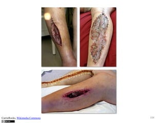 CarrieRocks, Wikimedia Commons

104	
  

 