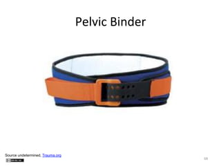 Pelvic	
  Binder
	
  

Source undetermined, Trauma.org

68	
  

 