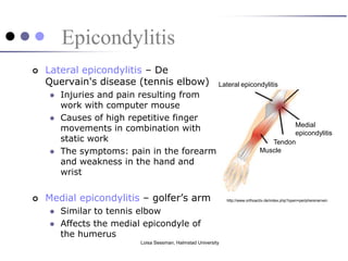 Epicondylitis
   Lateral epicondylitis – De
    Quervain's disease (tennis elbow)                      Lateral epicondylitis
       Injuries and pain resulting from
        work with computer mouse
       Causes of high repetitive finger
                                                                                          Medial
        movements in combination with                                                     epicondylitis
        static work                                                                 Tendon
       The symptoms: pain in the forearm                                        Muscle
        and weakness in the hand and
        wrist


   Medial epicondylitis – golfer’s arm                        http://www.orthoactiv.de/index.php?open=peripherenerven


       Similar to tennis elbow
       Affects the medial epicondyle of
        the humerus
                          Loisa Sessman, Halmstad University
 