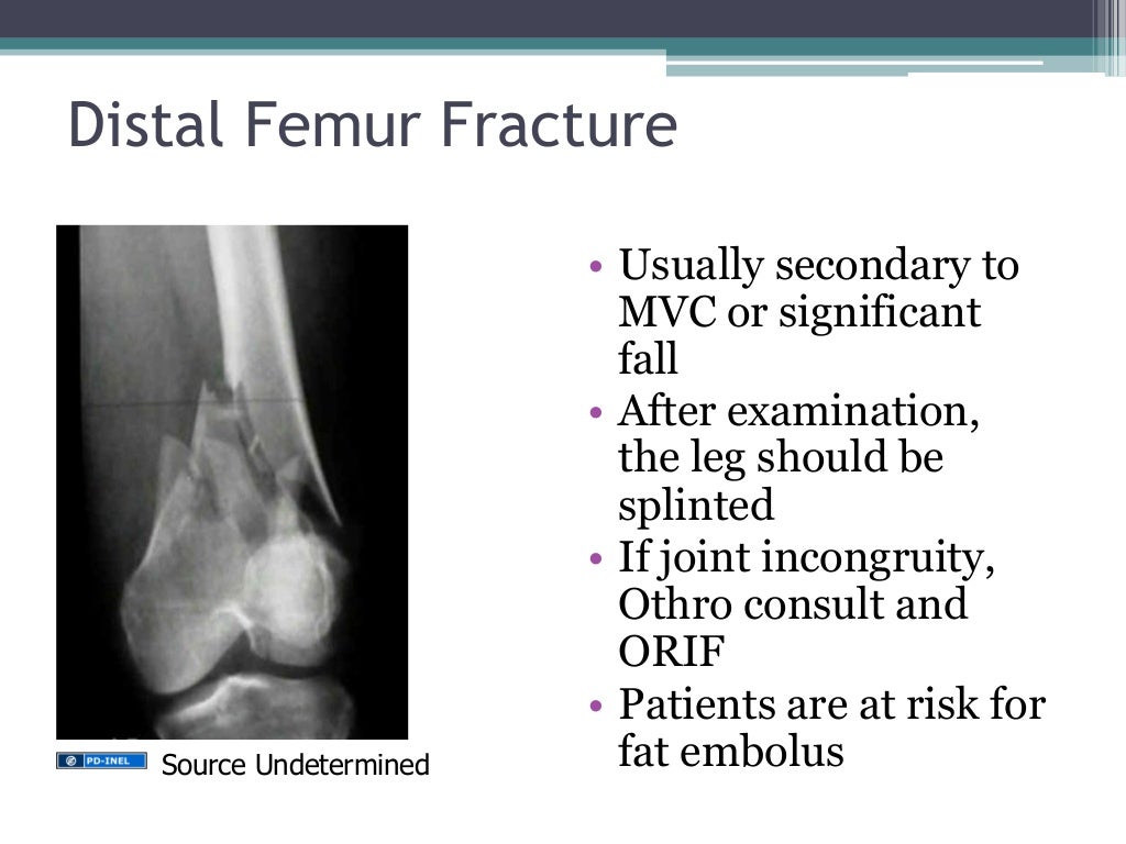 GEMC Lower extremity injuries Resident Training