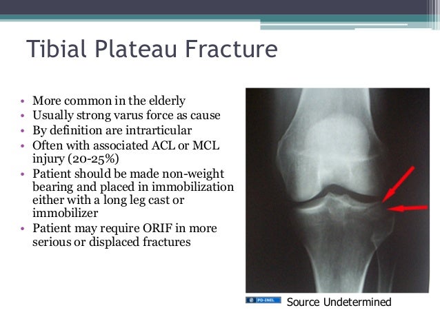 Gemc Lower Extremity Injuries Resident Training Gemc Lower Extremity Injuries Resident Training