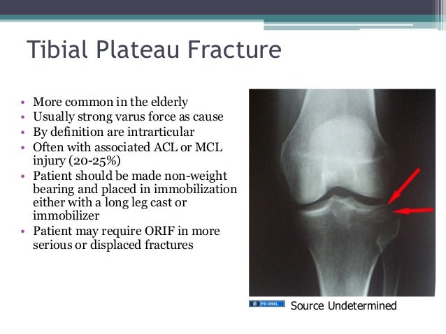 Gemc Lower Extremity Injuries Resident Training