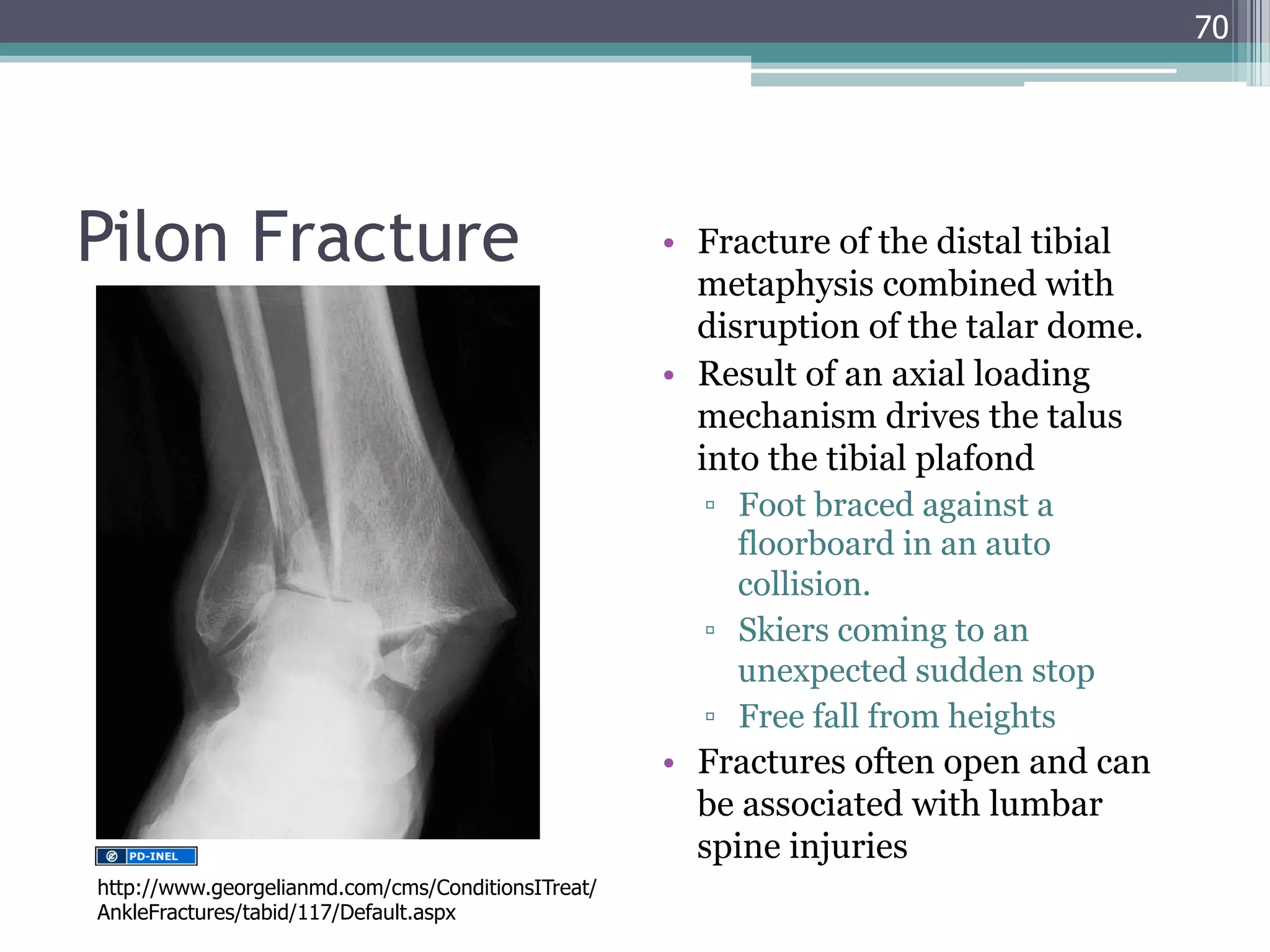 GEMC- Injuries of the Lower Extremity: Knee, Ankle and Foot- Resident  Training | PDF