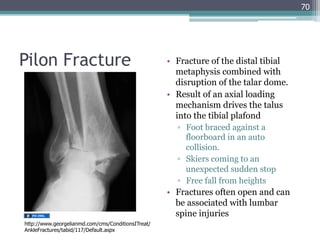 GEMC- Injuries of the Lower Extremity: Knee, Ankle and Foot- Resident ...