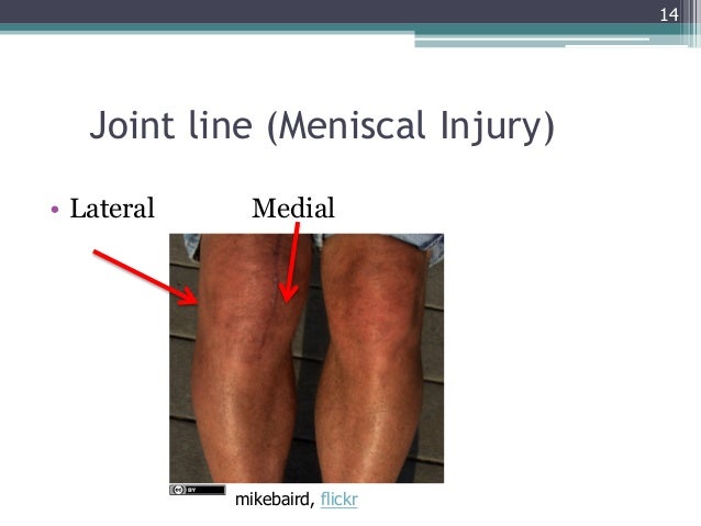 GEMC- Injuries of the Lower Extremity: Knee, Ankle and Foot- Resident…