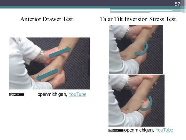 Gemc Injuries Of The Lower Extremity Knee Ankle And Foot Resident