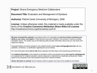 Project: Ghana Emergency Medicine Collaborative
Document Title: Evaluation and Management of Epistaxis
Author(s): Patrick Carter (University of Michigan), 2008
License: Unless otherwise noted, this material is made available under the
terms of the Creative Commons Attribution Share Alike-3.0 License:
http://creativecommons.org/licenses/by-sa/3.0/
We have reviewed this material in accordance with U.S. Copyright Law and have tried to maximize your
ability to use, share, and adapt it. These lectures have been modified in the process of making a publicly
shareable version. The citation key on the following slide provides information about how you may share and
adapt this material.
Copyright holders of content included in this material should contact open.michigan@umich.edu with any
questions, corrections, or clarification regarding the use of content.
For more information about how to cite these materials visit http://open.umich.edu/privacy-and-terms-use.
Any medical information in this material is intended to inform and educate and is not a tool for self-diagnosis
or a replacement for medical evaluation, advice, diagnosis or treatment by a healthcare professional. Please
speak to your physician if you have questions about your medical condition.
Viewer discretion is advised: Some medical content is graphic and may not be suitable for all viewers.
1	
  
 