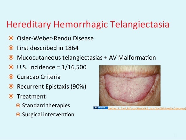 GEMC: Evaluation and Management of Epistaxis: Resident Training