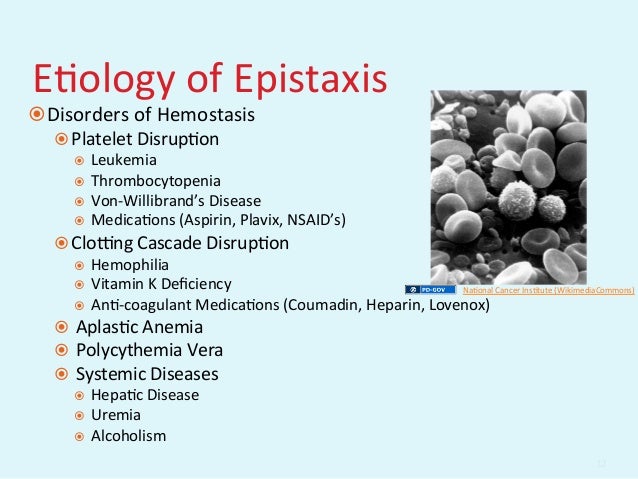 GEMC: Evaluation and Management of Epistaxis: Resident Training GEMC: Evaluation and Management of Epistaxis: Resident Training