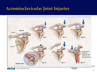 12	
  
Source:	
  Steve	
  Oh,	
  2004	
  
 