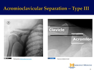 14	
  
Root4(one),	
  Wikimedia	
  Commons	
   Source	
  Undetermined	
  
 