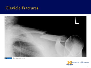 17	
  
Source	
  Undetermined	
  
 