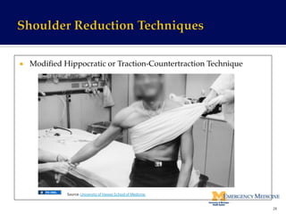 ¡  Modiﬁed Hippocratic or Traction-Countertraction Technique!
28	
  
Source:	
  University	
  of	
  Hawaii	
  School	
  of	
  Medicine	
  	
  
 