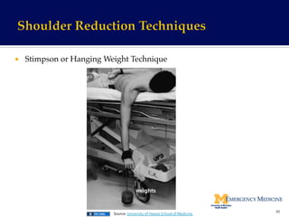 ¡  Stimpson or Hanging Weight Technique!
30	
  
Source:	
  University	
  of	
  Hawaii	
  School	
  of	
  Medicine	
  	
  
 