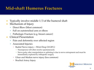 ¡  Typically involve middle 1/3 of the humeral shaft!
¡  Mechanism of Injury!
§  Direct Blow (Most common)!
§  Fall on outstretched arm or elbow!
§  Pathologic Fracture (e.g. breast cancer)!
¡  Clinical Presentation !
§  Pain and deformity over affected region!
§  Associated Injuries!
▪  Radial Nerve injury = Wrist Drop (10-20%)!
▪  Neuropraxia will often resolve spontaneously!
▪  Nerve palsy after manipulation or splinting is due to nerve entrapment and must be
immediately explored by orthopedic surgery!
▪  Ulnar and Median nerve injury (less common)!
▪  Brachial Artery Injury!
36	
  
 