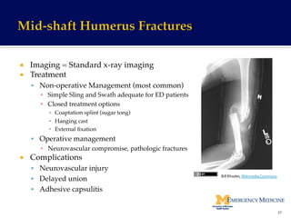 ¡  Imaging = Standard x-ray imaging!
¡  Treatment!
§  Non-operative Management (most common)!
▪  Simple Sling and Swath adequate for ED patients!
▪  Closed treatment options!
▪  Coaptation splint (sugar tong)!
▪  Hanging cast!
▪  External ﬁxation!
§  Operative management!
▪  Neurovascular compromise, pathologic fractures!
¡  Complications!
§  Neurovascular injury!
§  Delayed union!
§  Adhesive capsulitis!
37	
  
Bill	
  Rhodes,	
  Wikimedia	
  Commons	
  
 
