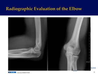 39	
  Source	
  Undetermined	
  
 