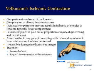 ¡  Compartment syndrome of the forearm!
¡  Complication of elbow/forearm fractures!
¡  Increased compartment pressure results in ischemia of muscles of
forearm, typically ﬂexor compartment!
¡  Patient complains of pain out of proportion of injury, digit swelling
and paresthesias!
¡  Also consider in any patient presenting with pain and numbness in
hand after casting has been performed!
¡  Irreversible damage in 6 hours (see image)!
¡  Treatment !
§  Removal of cast!
§  Surgical decompression with fasciotomy!
45	
  
Source	
  Undetermined	
  
 
