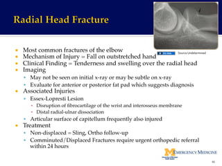 ¡  Most common fractures of the elbow!
¡  Mechanism of Injury = Fall on outstretched hand!
¡  Clinical Finding = Tenderness and swelling over the radial head!
¡  Imaging!
§  May not be seen on initial x-ray or may be subtle on x-ray!
§  Evaluate for anterior or posterior fat pad which suggests diagnosis!
¡  Associated Injuries!
§  Essex-Lopresti Lesion !
▪  Disruption of ﬁbrocartilage of the wrist and interosseus membrane!
▪  Distal radial-ulnar dissociation!
§  Articular surface of capitellum frequently also injured!
¡  Treatment!
§  Non-displaced = Sling, Ortho follow-up!
§  Comminuted/Displaced Fractures require urgent orthopedic referral
within 24 hours!
46	
  
Source	
  Undetermined	
  
 