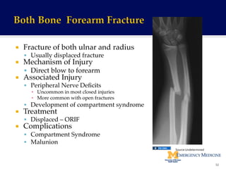 ¡  Fracture of both ulnar and radius!
§  Usually displaced fracture!
¡  Mechanism of Injury !
§  Direct blow to forearm!
¡  Associated Injury!
§  Peripheral Nerve Deﬁcits!
▪  Uncommon in most closed injuries!
▪  More common with open fractures!
§  Development of compartment syndrome!
¡  Treatment!
§  Displaced – ORIF!
¡  Complications!
§  Compartment Syndrome!
§  Malunion!
52	
  
Source	
  Undetermined	
  
 