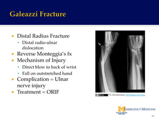 ¡  Distal Radius Fracture!
§  Distal radio-ulnar
dislocation!
¡  Reverse Monteggia’s fx!
¡  Mechanism of Injury!
§  Direct blow to back of wrist!
§  Fall on outstretched hand!
¡  Complication = Ulnar
nerve injury!
¡  Treatment = ORIF !
http://www.learningradiology.com/caseofweek/
caseoftheweekpix2/cow157lg.jpg	
  
54	
  
Th.	
  Zimmermann,	
  Wikimedia	
  Commons	
  
 