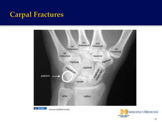 60	
  
Source	
  Undetermined	
  
 