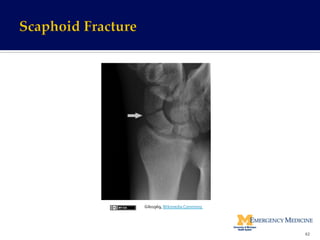 62	
  
Gilo1969,	
  Wikimedia	
  Commons	
  	
  
 