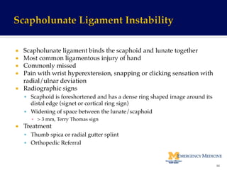 ¡  Scapholunate ligament binds the scaphoid and lunate together!
¡  Most common ligamentous injury of hand!
¡  Commonly missed!
¡  Pain with wrist hyperextension, snapping or clicking sensation with
radial/ulnar deviation!
¡  Radiographic signs!
§  Scaphoid is foreshortened and has a dense ring shaped image around its
distal edge (signet or cortical ring sign)!
§  Widening of space between the lunate/scaphoid !
▪  > 3 mm, Terry Thomas sign!
¡  Treatment !
§  Thumb spica or radial gutter splint!
§  Orthopedic Referral!
66	
  
 