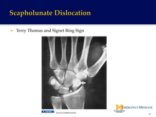 ¡  Terry Thomas and Signet Ring Sign!
67	
  
Source	
  Undetermined	
  
 