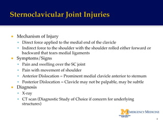 ¡  Mechanism of Injury!
§  Direct force applied to the medial end of the clavicle!
§  Indirect force to the shoulder with the shoulder rolled either forward or
backward that tears medial ligaments!
¡  Symptoms/Signs!
§  Pain and swelling over the SC joint!
§  Pain with movement of shoulder!
§  Anterior Dislocation = Prominent medial clavicle anterior to sternum!
§  Posterior Dislocation = Clavicle may not be palpable, may be subtle!
¡  Diagnosis!
§  X-ray!
§  CT scan (Diagnostic Study of Choice if concern for underlying
structures)!
8	
  
 