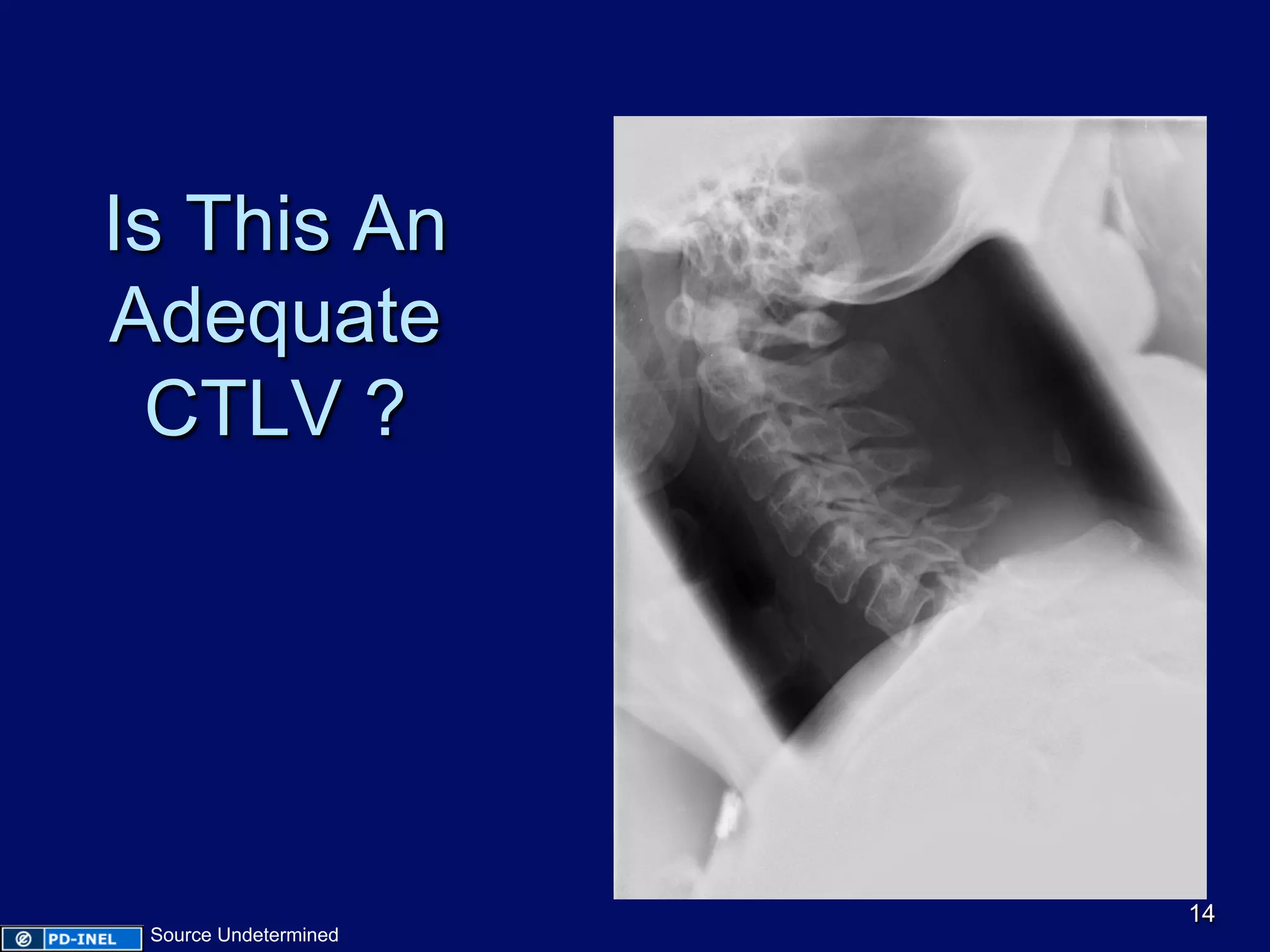 Is This An
Adequate
CTLV ?
14
Source Undetermined
 