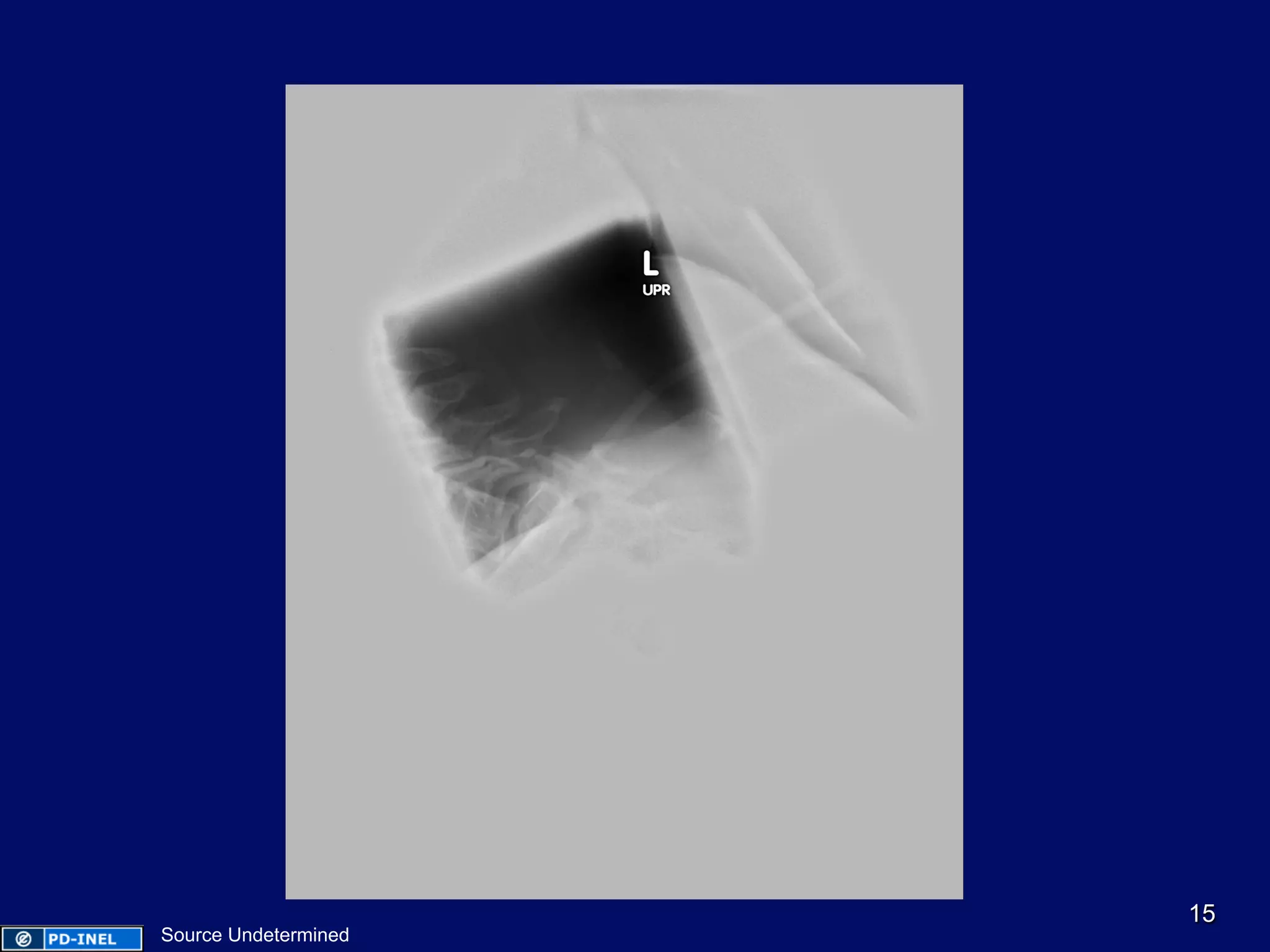 15
Source Undetermined
 