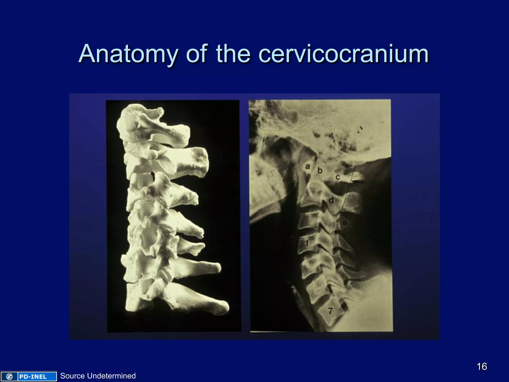 Anatomy of the cervicocranium
16
Source Undetermined
 