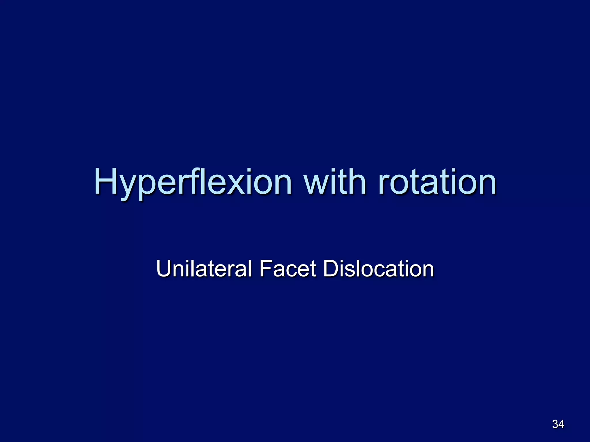 Hyperflexion with rotation
Unilateral Facet Dislocation
34
 
