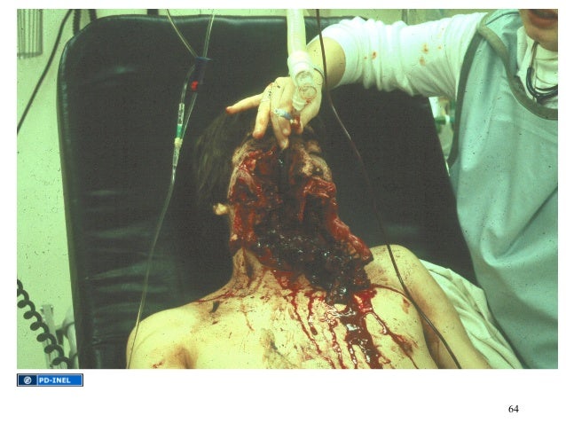 Gemc Gunshot Wounds Resident Training Gemc Gunshot Wounds Resident Training