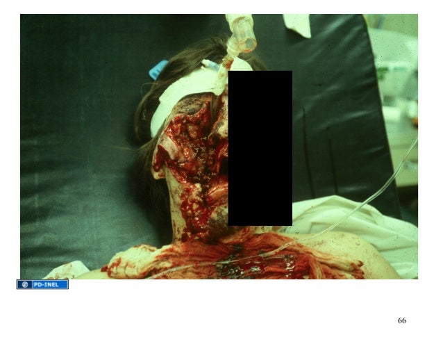 Gemc Gunshot Wounds Resident Training