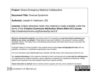 Project: Ghana Emergency Medicine Collaborative
Document Title: Overuse Syndrome
Author(s): Joseph H. Hartmann, DO
License: Unless otherwise noted, this material is made available under the
terms of the Creative Commons Attribution Share Alike-3.0 License:
http://creativecommons.org/licenses/by-sa/3.0/
We have reviewed this material in accordance with U.S. Copyright Law and have tried to maximize your
ability to use, share, and adapt it. These lectures have been modified in the process of making a publicly
shareable version. The citation key on the following slide provides information about how you may share and
adapt this material.
Copyright holders of content included in this material should contact open.michigan@umich.edu with any
questions, corrections, or clarification regarding the use of content.
For more information about how to cite these materials visit http://open.umich.edu/privacy-and-terms-use.
Any medical information in this material is intended to inform and educate and is not a tool for self-diagnosis
or a replacement for medical evaluation, advice, diagnosis or treatment by a healthcare professional. Please
speak to your physician if you have questions about your medical condition.
Viewer discretion is advised: Some medical content is graphic and may not be suitable for all viewers.

1

 