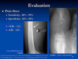 Evaluation
 

Plain films:
 
 

 
 

Sensitivity: 28% - 93%
Specificity: 33% - 92%
+LR: ~2.2
-LR: ~0.5

LearningRadiology.com
Learch TJ and Gentili A. Advanced Imaging of the Diabetic Foot and
Its Complications. American Journal of Roentgenology; 2000:175(5):1328.

Source undetermined

23

 