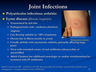 Joint Infections
 
 

Polyarticular infectious arthritis:
Lyme disease (Borrelia burgdorferi)
 
 

 
 
 

 

 

Transmitted by tick bite
Pathognomonic rash: erythema chronicm
migrans
Can develop arthritis in ~50% of patients
Hannah Garrison,
Occurs late in illness (weeks to years)
Wikimedia Commons
Usually afebrile with asymmetric arthritis, primarily affecting large
joints
Treat with extended course of oral antibiotics (doxycycline or
amoxicillin)
Admit if patient has additional neurologic or cardiac manifestations for
treatment with IV antibiotics

Rudor S and Lewiss RE. Arthritis in the ED: detecting high-risk etiologies and providing effective pain
management. Emergency Medicine Practice; 2004:6(10).

31

 