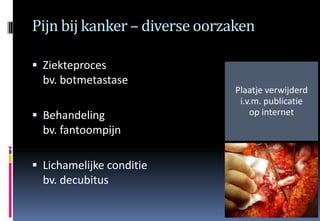 Pijn bij kanker – diverse oorzaken

 Ziekteproces
  bv. botmetastase
                              Plaatje verwijderd
                               i.v.m. publicatie
 Behandeling                     op internet
  bv. fantoompijn

 Lichamelijke conditie
  bv. decubitus
 